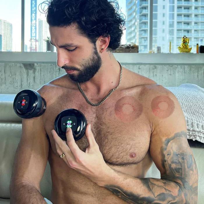Feelflex™- Electric Cupping Therapy Vacuum Cupping Therapy