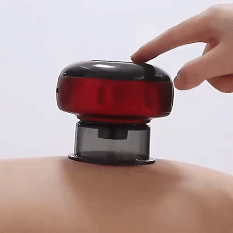 Feelflex™- Electric Cupping Therapy Vacuum Cupping Therapy