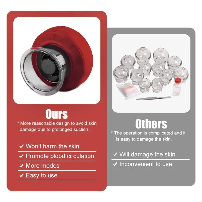 Feelflex™- Electric Cupping Therapy Vacuum Cupping Therapy